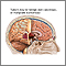 Tumor cerebral