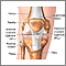 Ligamento cruzado anterior reparación - serie