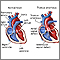 Tronco arterial