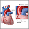 Ventana aortopulmonar