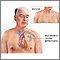 Cardiodesfibrilador implantable