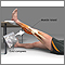 Tratamiento para distensión de la rodilla