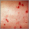 Eritema multiforme en la pierna