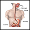 Esofagogastroduodenoscopia (EGD)
