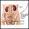 Biopsia ureteral