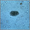 Huevo de anquilostoma