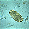 Huevo de Ascaris lumbricoides
