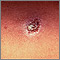 Primer plano de Leishmania panamensis