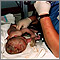 Cuidado del neonato después del parto
