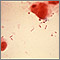 Organismo Haemophilus influenzae