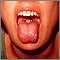 Mononucleosis - boca