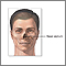 Septoplastia - serie - Anatoma septal