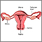 Corte transversal de anatomía uterina normal