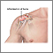Bursitis del hombro