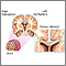 Cuerpo calloso del cerebro