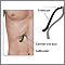 Endoscopia de vesícula biliar
