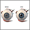 Antes y después de cirugía corneal