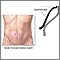 Incisión para realizar laparoscopia abdominal