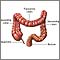 Intestino grueso