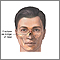 Fractura nasal