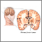 Tumor cerebral primario