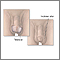 Biopsia testicular