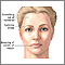 Caída facial