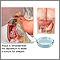 Cultivo del tejido duodenal