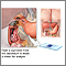 Frotis del tejido duodenal