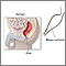 Biopsia rectal