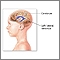 Ventrículos del cerebro
