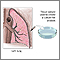 Biopsia de tejido pulmonar