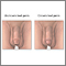 Higiene reproductiva masculina