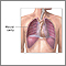 Cavidad pleural