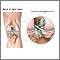 Ligamento cruciforme posterior de la rodilla