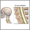 Espondilosis cervical