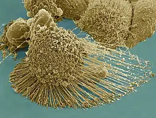 Micrografía electrónica de una célula HeLa apoptótica. Zeiss Merlin HR-SEM.