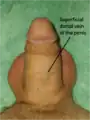 La vena dorsal superficial en un pene flácido.