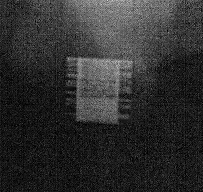 Una imagen de rayos X del ZSI 375 implantado. El dispositivo está activado: el resorte se descomprime en la parte superior del cilindro. El paciente es continente.