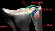 Se aprecian sus inserciones cubitales en la estiloides y en la fóvea cubital.