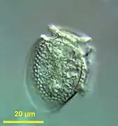 Dinophysis acuminata (Dinophyceae)