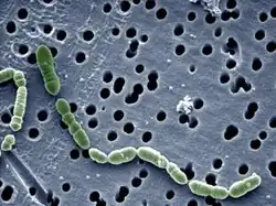 Oenococcus oeni