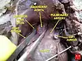 Aorta ascendente fetal