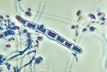 Macroconidios de T. rubrum