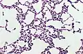 Bacillus coagulans