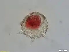 Difflugia corona (Tubulinea)