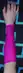 antebrazo