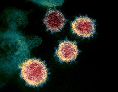 Imagen microscópica de SARS-CoV-2, el virus que causa COVID-19. Se observan proteínas